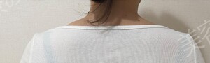 治療前の症例写真
