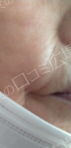 治療前の症例写真