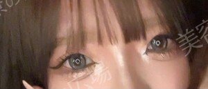 治療直後の症例写真