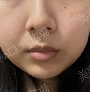 治療前の症例写真