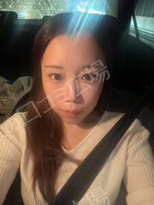 ボトックス韓国製200単位｜エラ・肩・ワキ・ふくらはぎからの治療結果の症例写真