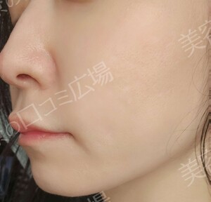 治療結果の症例写真