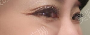 治療結果の症例写真