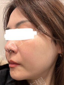 治療前の症例写真