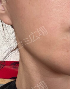 治療前の症例写真
