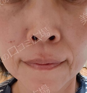 治療結果の症例写真