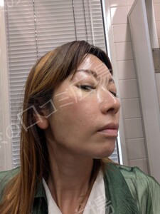 治療前の症例写真
