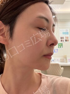 治療前の症例写真
