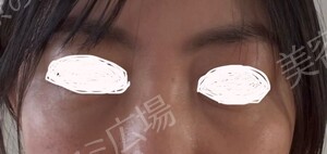 治療前の症例写真