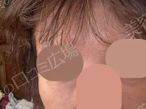 治療結果の症例写真