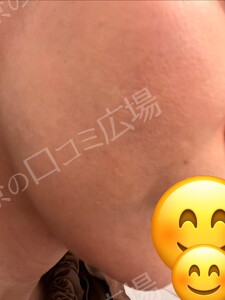 治療結果の症例写真