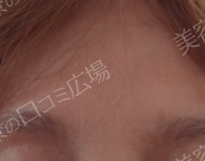治療結果の症例写真