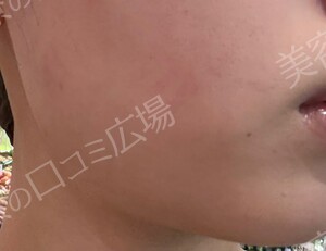 治療前の症例写真