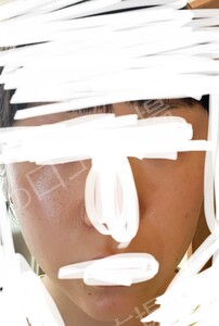治療直後の症例写真