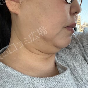 治療前の症例写真
