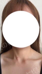 治療直後の症例写真