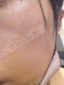 治療結果の症例写真