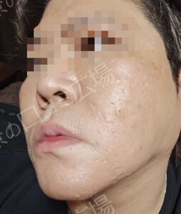 治療結果の症例写真