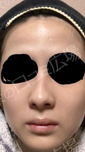 治療結果の症例写真