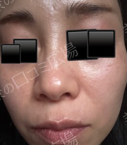 治療結果の症例写真