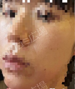 治療結果の症例写真