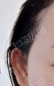 治療結果の症例写真