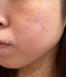 治療前の症例写真
