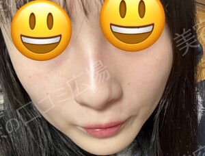 治療前の症例写真