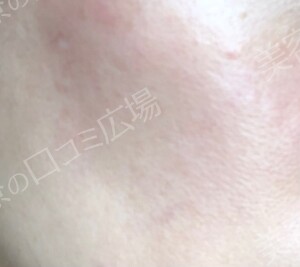 治療結果の症例写真