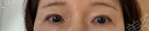 治療結果の症例写真