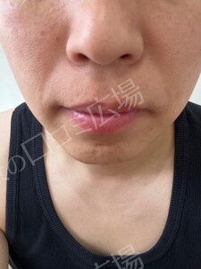 治療結果の症例写真