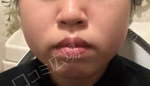 治療前の症例写真
