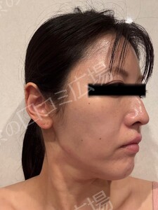 治療前の症例写真