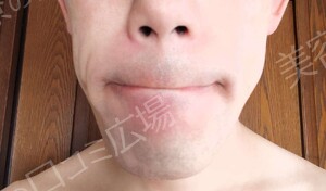 治療結果の症例写真