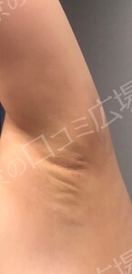 治療結果の症例写真