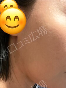 治療結果の症例写真