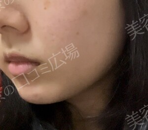 治療前の症例写真