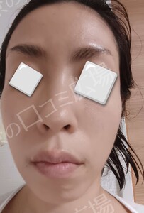 治療結果の症例写真