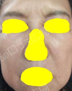 治療前の症例写真
