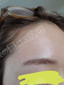 治療結果の症例写真