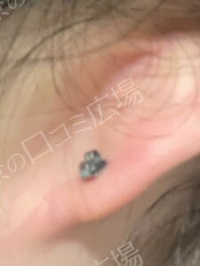 治療結果の症例写真
