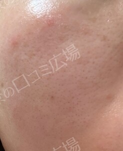 治療結果の症例写真