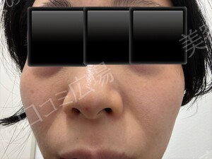 治療前の症例写真