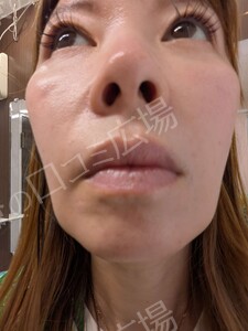 治療前の症例写真