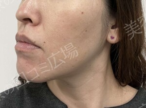 治療前の症例写真