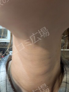 治療前の症例写真