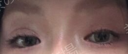 治療前の症例写真