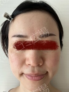 治療結果の症例写真
