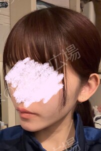 治療結果の症例写真