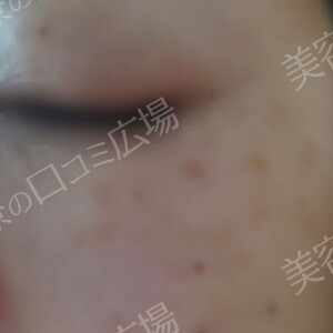 治療前の症例写真